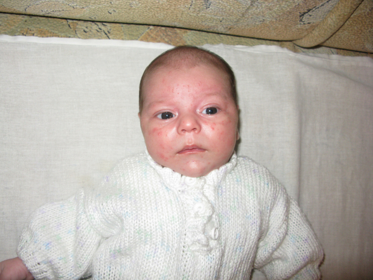 Аллергия или фиг знает что!?