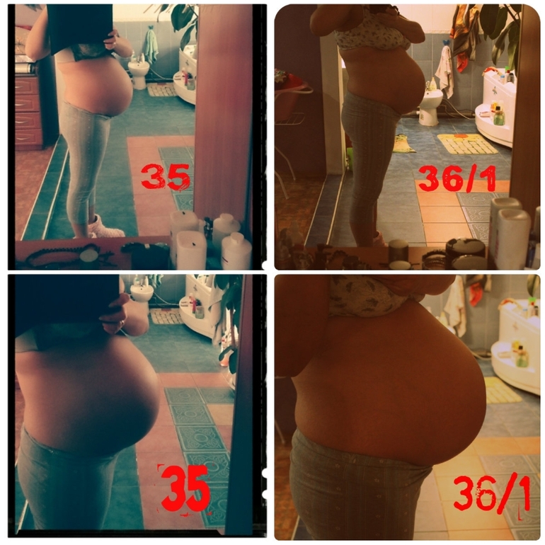 Пузорост с 9 нед по 36 нед