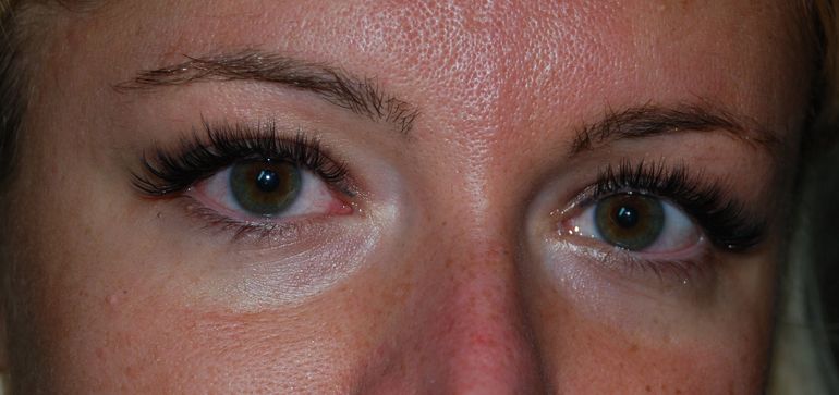 Объемное наращивание