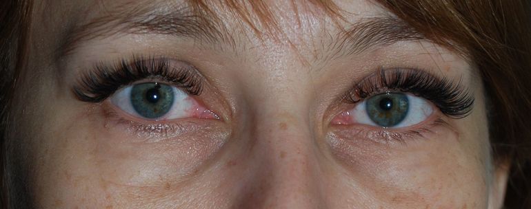 Объемное наращивание