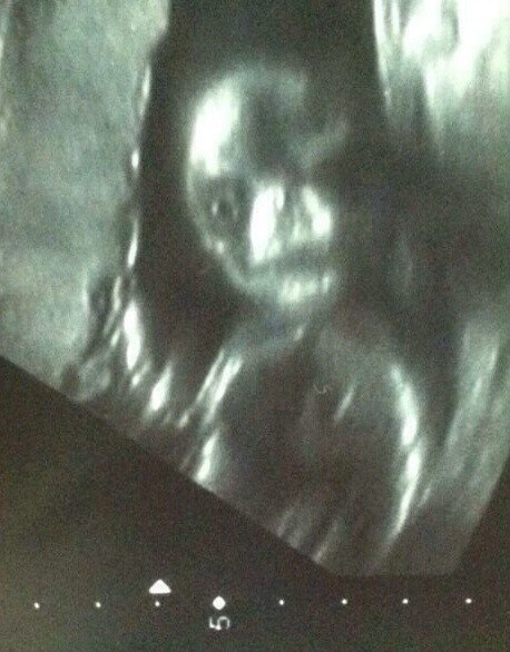 хихихи!! у нас мальчик)))))))))