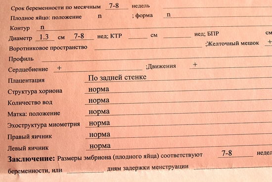 Девочки, разбирайте приманочки, которые очень помогали мне)