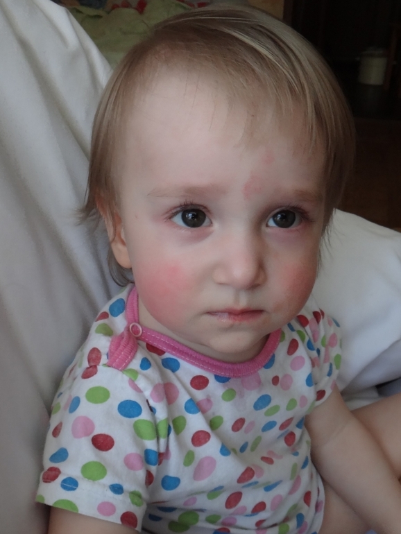 Красные щечки