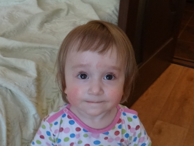 Красные щечки