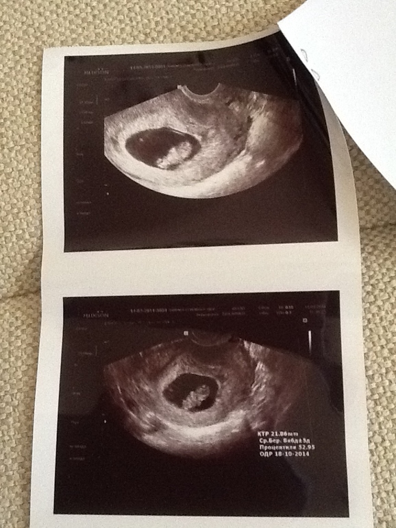 Нам 9 недель)))