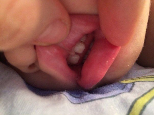 Проблемы с зубами, нам 1,8.