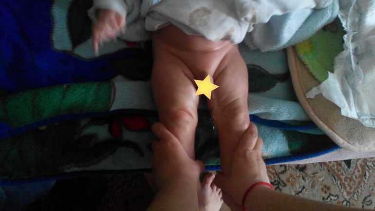 все ли хорошо со складочками?