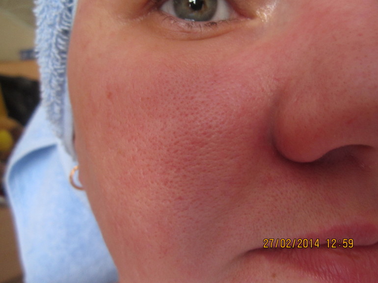 что можно сделать с этим?