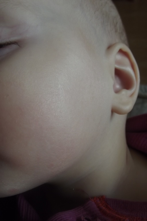 В погоне за чистой кожей