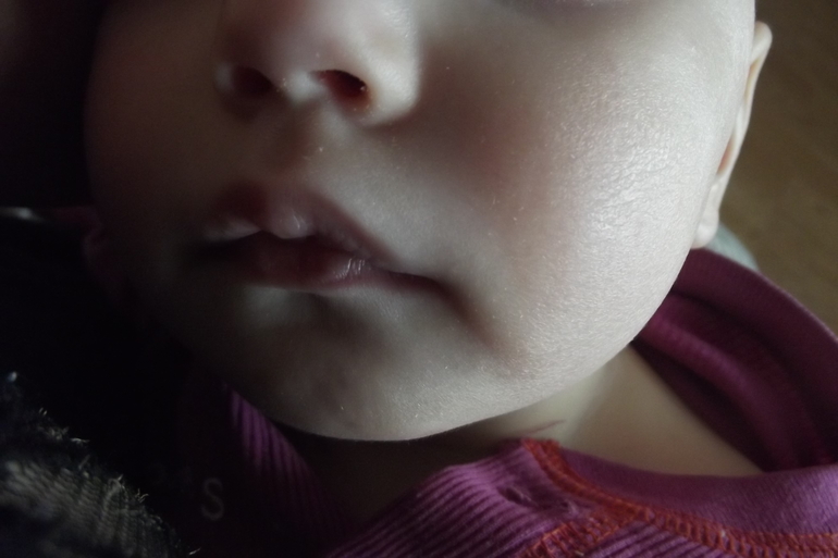 В погоне за чистой кожей