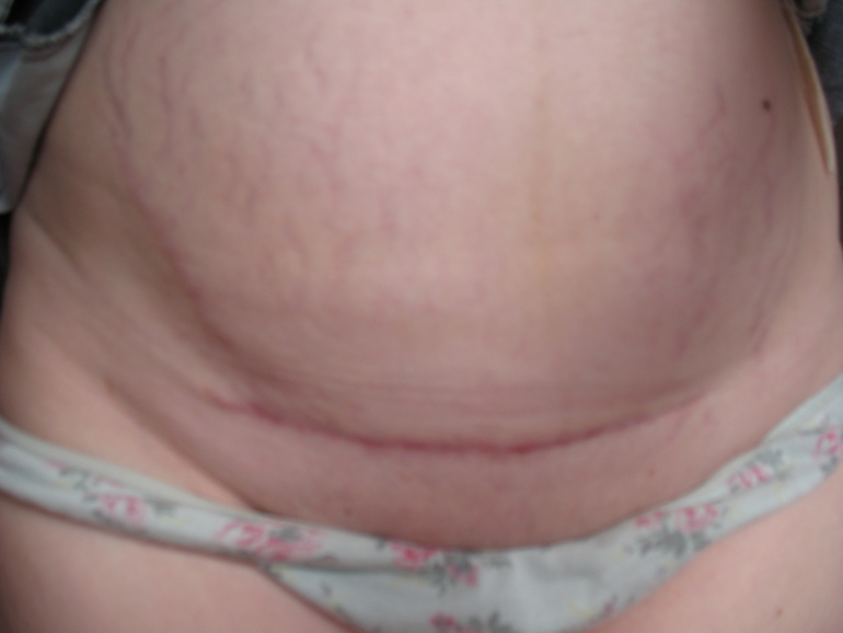 ужасная картина...за что хвататься?