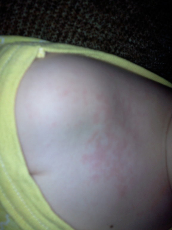 Реактивная кожа?