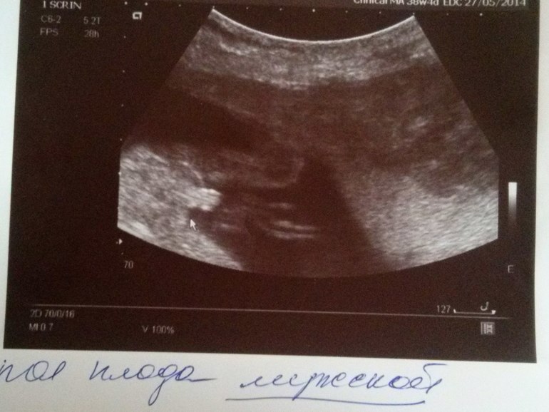 Пяты  мальчик!!!!!