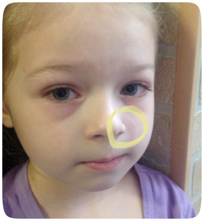 Непонятное пятнышко?