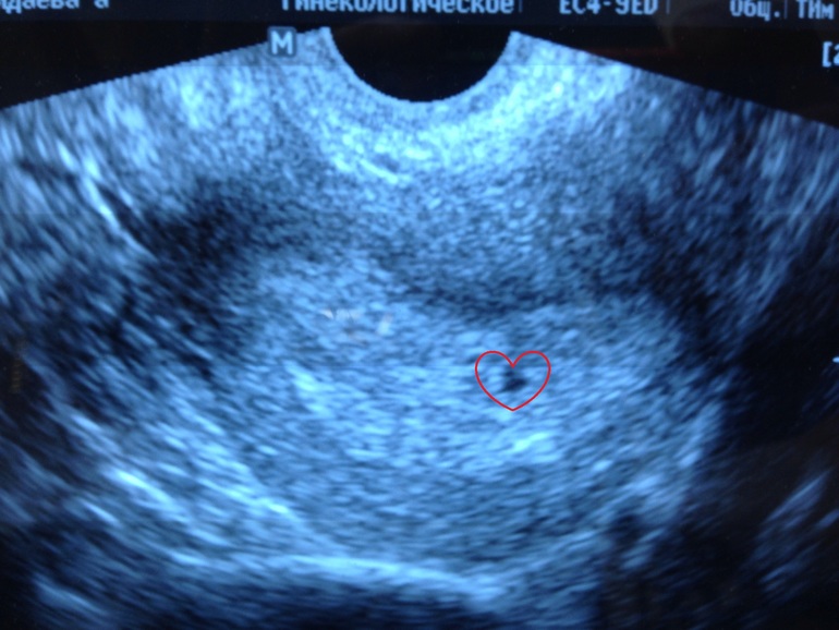 Мы с маковкой пришли знакомиться)