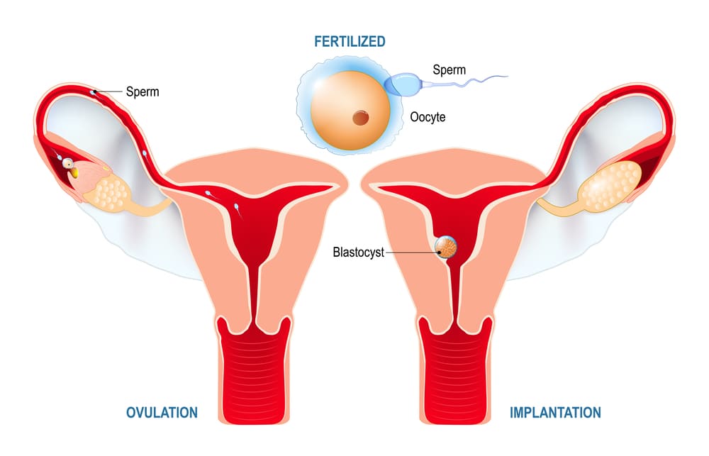 Признаки и особенности имплантации эмбриона