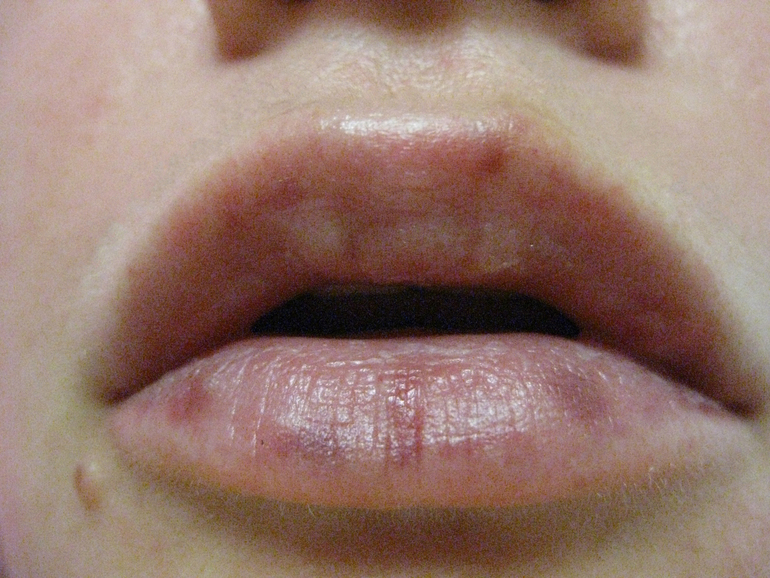 Отзыв о выигранной