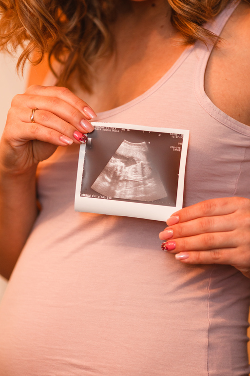 Второй скрининг 21 нед.