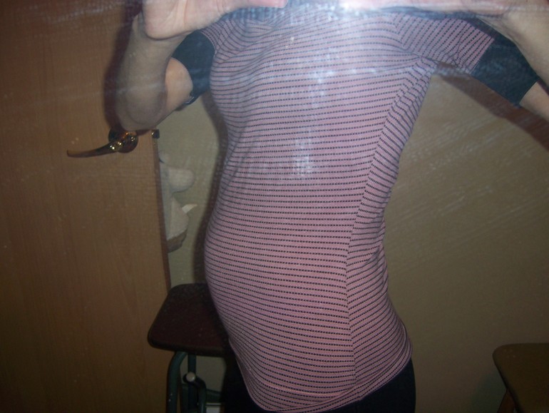 17 недель, токсикоз (или его отсутствие?), УЗИ 2-го скриннинга и фото животика