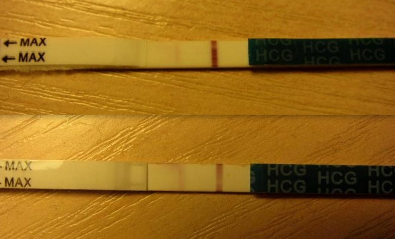 Может ли быть такое при кисте?