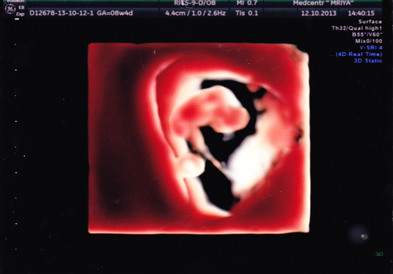 Скоро на УЗИ)))