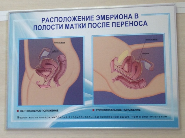cac5edf1c5b33beb8068d7cdb79e521b.jpg
