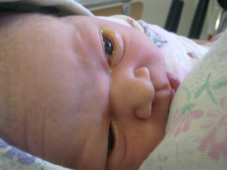 Мои 4-е роды (есть немного фоток)