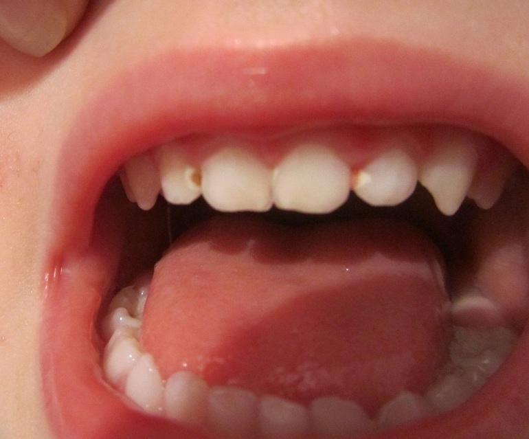 начали лечение