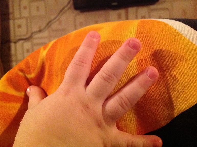 ПОМОГИТЕ! грызет ногти