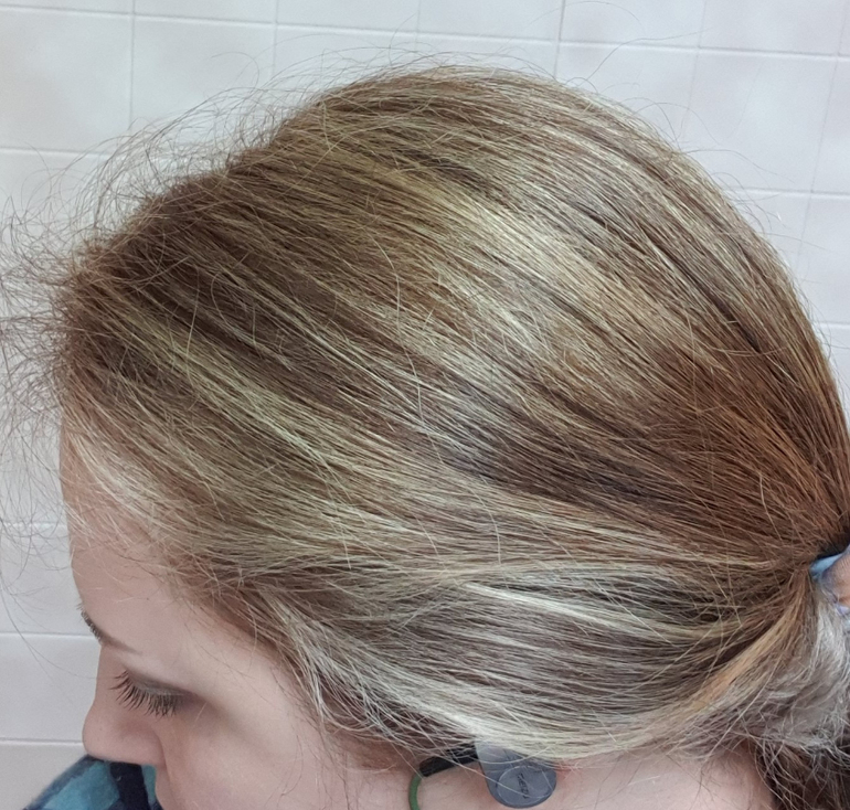 мелирование с тонированием. частое мелирование до и после. волосы после мелирования отзывы. мелирование на отросшие корни осветленных волос. мелирование на темные волосы до и после.