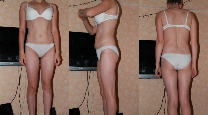 История моего похудения