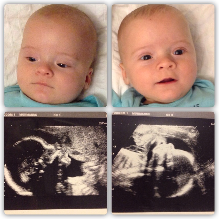 Нам 5 месяцев!!!