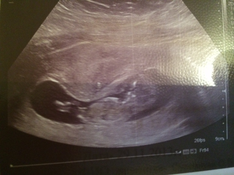 У кого какое серцебиение у малыша???