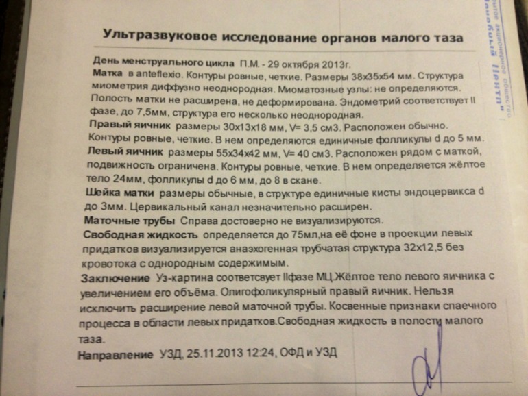 Узи показало.. (((