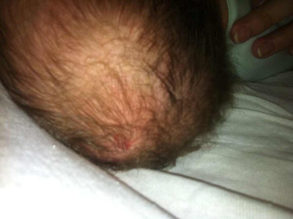 красное пятно