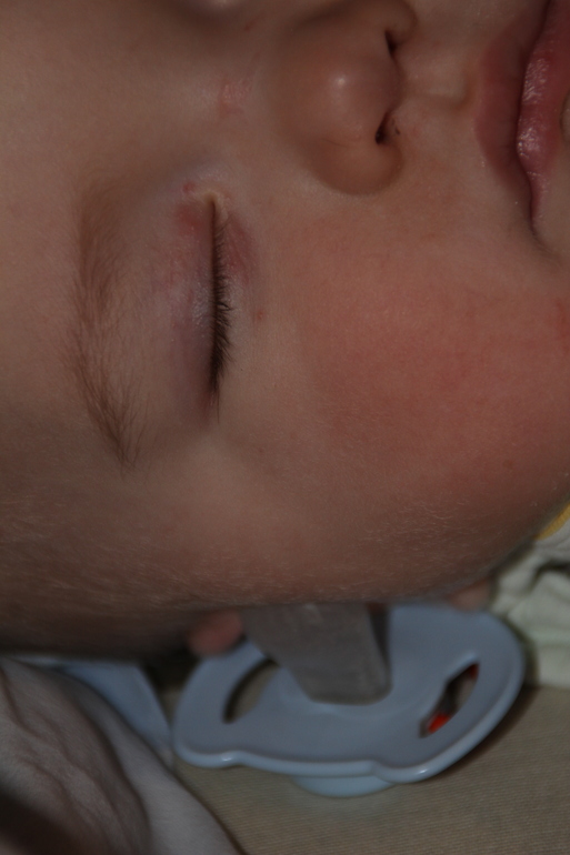 Псориаз? или что?