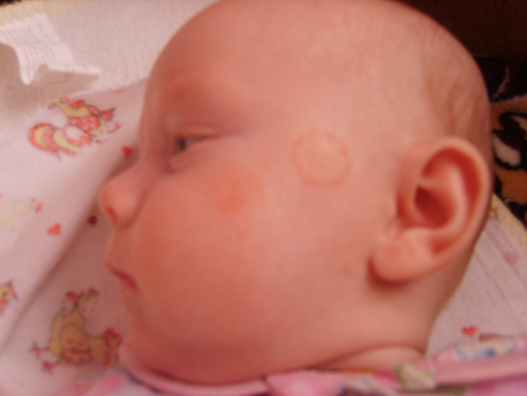 Пятно! Может у кого такое было?