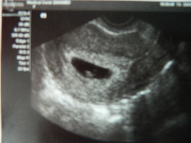 Для ВАС, дорогие, заразные вещицы))))