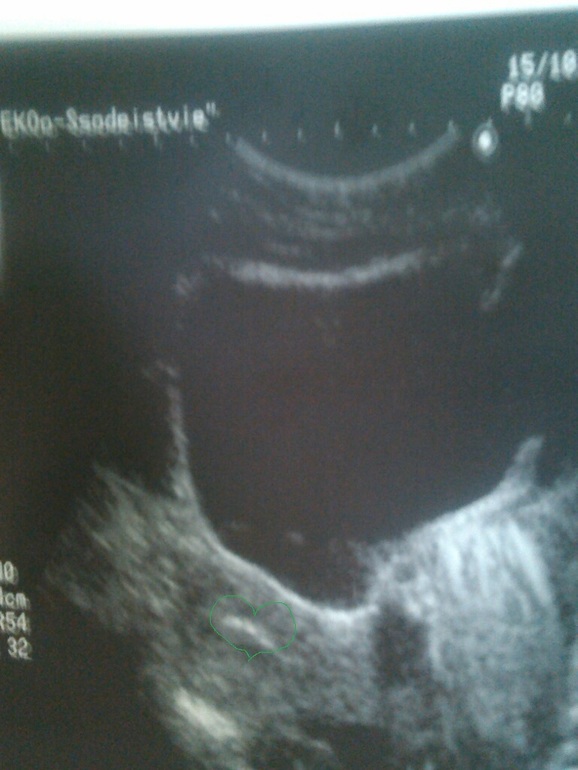 Со мной мои звездочки)))