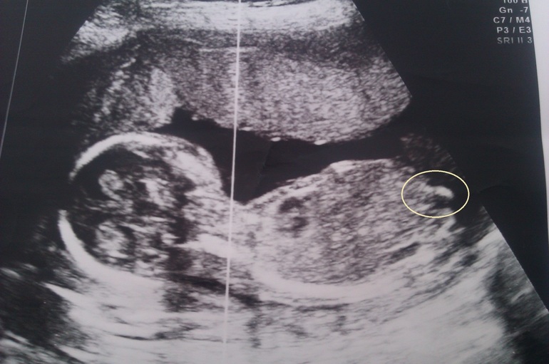 наше счастье (продолжение)