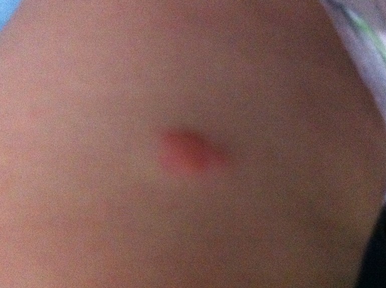 два пятнышка...что это???