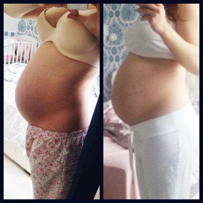 нужно мнение незасимых экспертов)