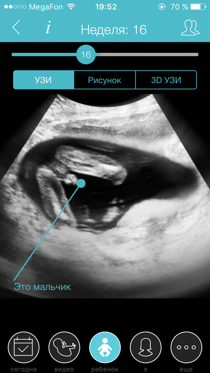 Пол мальчика. УЗИ на 17 неделе беременности пол ребенка мальчика. УЗИ 17 недель беременности пол. УЗИ 18 недель беременности пол мальчик. УЗИ на 20 неделе беременности пол мальчик.