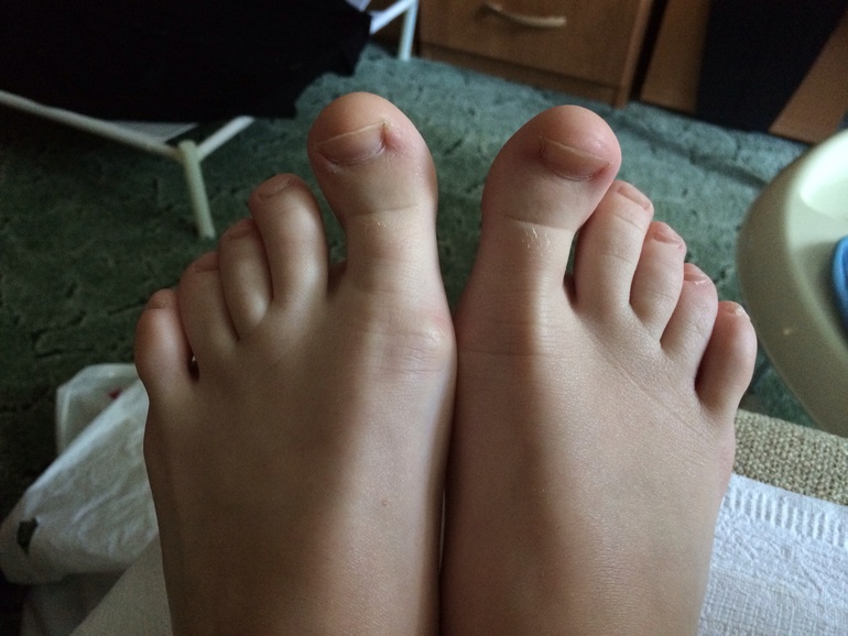Не красивая форма ногтей на ногах. — 24 ответов | форум Babyblog