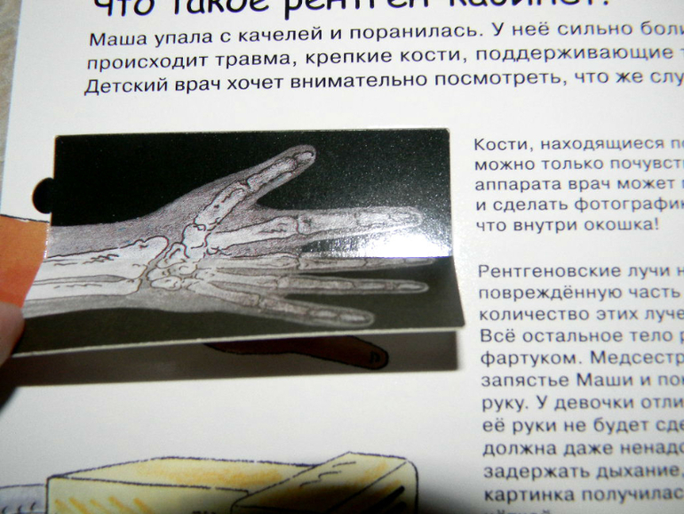 анатомия