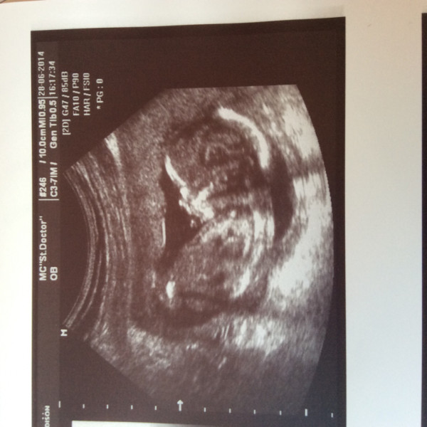 16 недель 5 дней. 16 Неделя беременности фото малыша УЗИ. 16 Недель беременности по УЗИ.