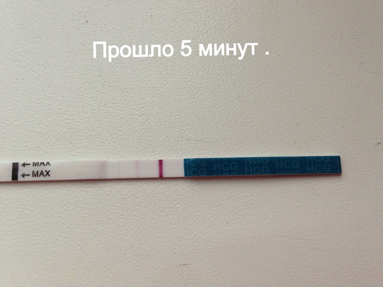 Сделала 14 дпо ) посмотрите как идет процесс)