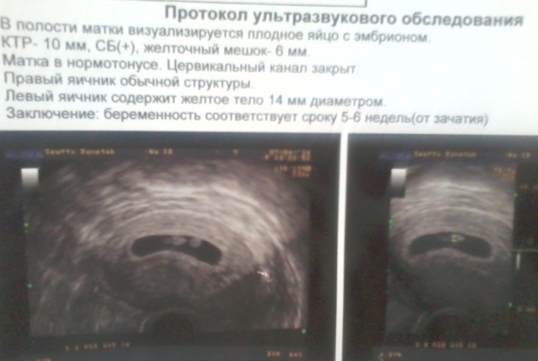 Покажу и я свою зайку .8 неделька