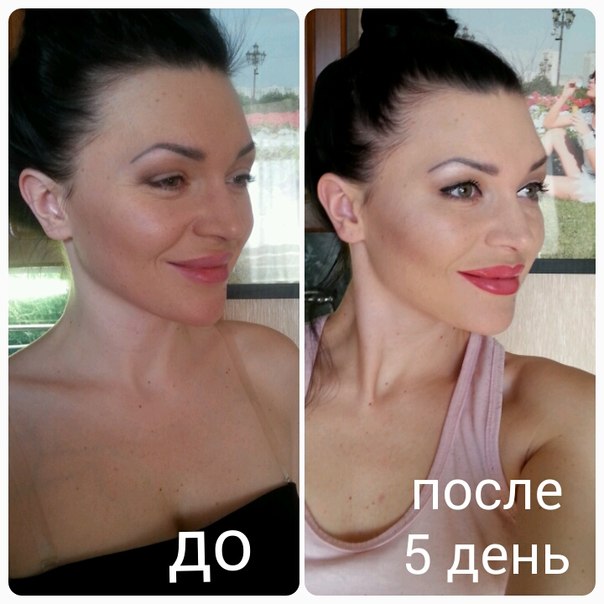 Бота 070 фото до и после