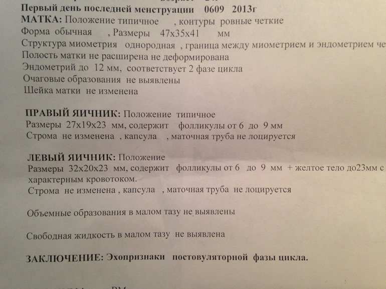 Узи